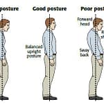Comparison of poor posture vs good posture, highlighting forward head and sway back issues.