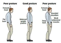 Comparison of poor posture vs good posture, highlighting forward head and sway back issues.
