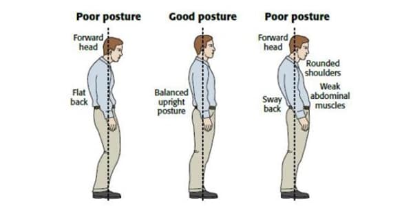 Showing effects of Postural Stress Syndrome, highlighting muscle imbalances and strain due to prolonged poor posture such as forward head, rounded shoulders, and sway back.